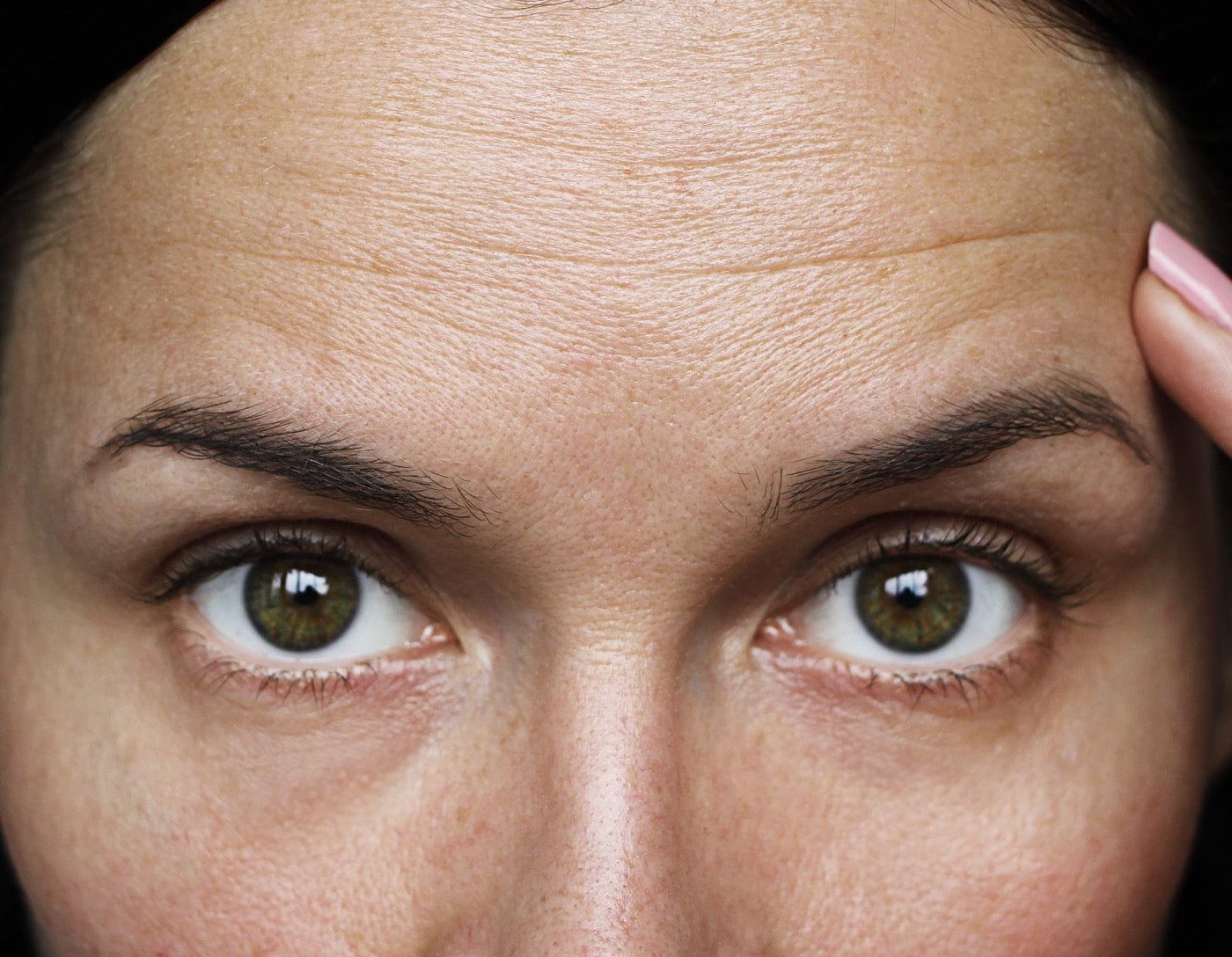 Womens face showing forehead wrinkles